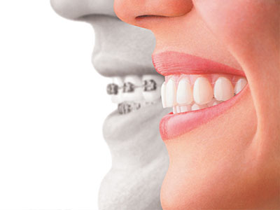 The image features a split-screen comparison between a person s natural teeth and a set of dental implants, with the two sides showing a significant difference in appearance and texture.